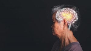 Picture of an older woman with an illustrated brain on her head to demonstrate dementia.
